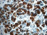 Pancreatic Lipase Antibody in Immunohistochemistry (Paraffin) (IHC (P))