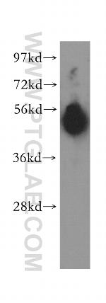 Pancreatic Lipase Antibody in Western Blot (WB)