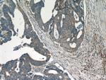 PTPN2 Antibody in Immunohistochemistry (Paraffin) (IHC (P))