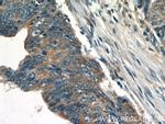 PTPN2 Antibody in Immunohistochemistry (Paraffin) (IHC (P))