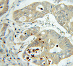 PTPN2 Antibody in Immunohistochemistry (Paraffin) (IHC (P))