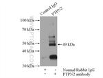 PTPN2 Antibody in Immunoprecipitation (IP)