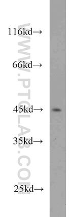 PTPN2 Antibody in Western Blot (WB)