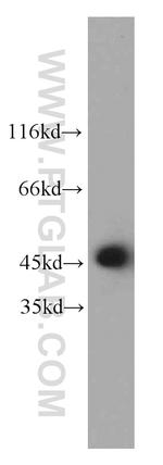 PTPN2 Antibody in Western Blot (WB)