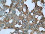 ALDOA Antibody in Immunohistochemistry (Paraffin) (IHC (P))