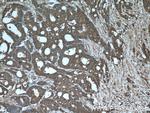 ALDOA Antibody in Immunohistochemistry (Paraffin) (IHC (P))