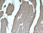 ALDOA Antibody in Immunohistochemistry (Paraffin) (IHC (P))