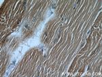 ALDOA Antibody in Immunohistochemistry (Paraffin) (IHC (P))