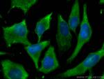 ALDOA Antibody in Immunocytochemistry (ICC/IF)