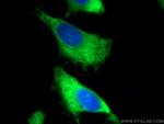 ALDOA Antibody in Immunocytochemistry (ICC/IF)