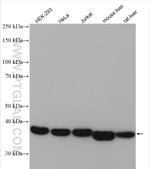 ALDOA Antibody in Western Blot (WB)