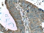 ALDOA Antibody in Immunohistochemistry (Paraffin) (IHC (P))