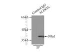 ALDOA Antibody in Immunoprecipitation (IP)