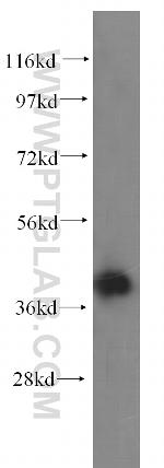 ALDOA Antibody in Western Blot (WB)