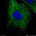 alpha Tubulin Antibody in Immunocytochemistry (ICC/IF)