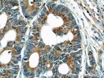 alpha Tubulin Antibody in Immunohistochemistry (Paraffin) (IHC (P))