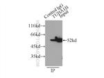 alpha Tubulin Antibody in Immunoprecipitation (IP)