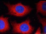 alpha Tubulin Antibody in Immunocytochemistry (ICC/IF)