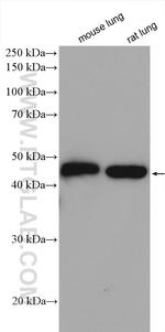 gamma Actin Antibody in Western Blot (WB)