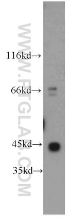 gamma Actin Antibody in Western Blot (WB)