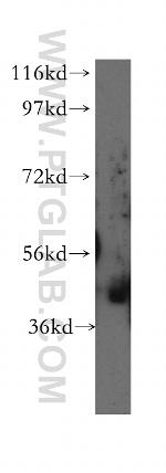 gamma Actin Antibody in Western Blot (WB)