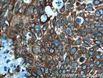 MAP4 Antibody in Immunohistochemistry (Paraffin) (IHC (P))