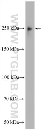 MAP4 Antibody in Western Blot (WB)