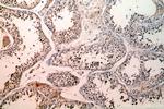 SETDB1 Antibody in Immunohistochemistry (Paraffin) (IHC (P))