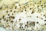 SETDB1 Antibody in Immunohistochemistry (Paraffin) (IHC (P))