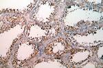 SETDB1 Antibody in Immunohistochemistry (Paraffin) (IHC (P))