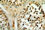 SETDB1 Antibody in Immunohistochemistry (Paraffin) (IHC (P))