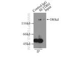 SETDB1 Antibody in Immunoprecipitation (IP)