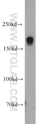 SETDB1 Antibody in Western Blot (WB)