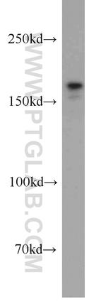 SETDB1 Antibody in Western Blot (WB)