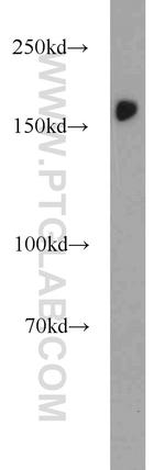 SETDB1 Antibody in Western Blot (WB)