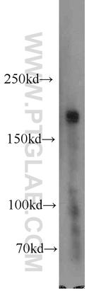 SETDB1 Antibody in Western Blot (WB)