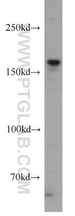 SETDB1 Antibody in Western Blot (WB)