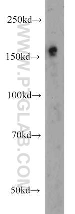 SETDB1 Antibody in Western Blot (WB)