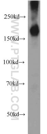 SETDB1 Antibody in Western Blot (WB)