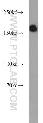 SETDB1 Antibody in Western Blot (WB)