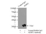 AEBP2 Antibody in Immunoprecipitation (IP)