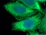 EIF2A Antibody in Immunocytochemistry (ICC/IF)