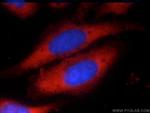 EIF2A Antibody in Immunocytochemistry (ICC/IF)