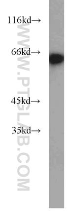 EIF2A Antibody in Western Blot (WB)