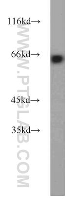 EIF2A Antibody in Western Blot (WB)