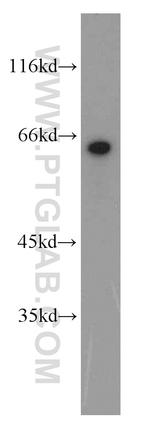 EIF2A Antibody in Western Blot (WB)