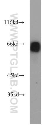 EIF2A Antibody in Western Blot (WB)