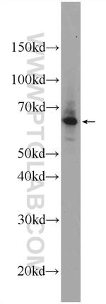 EIF2A Antibody in Western Blot (WB)