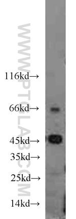 FLCN Antibody in Western Blot (WB)