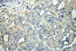 FLCN Antibody in Immunohistochemistry (Paraffin) (IHC (P))